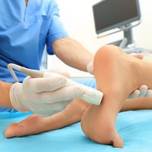 Patient with a sprained ankle in Auburn, AL.